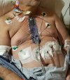 FirstSurgery.jpg